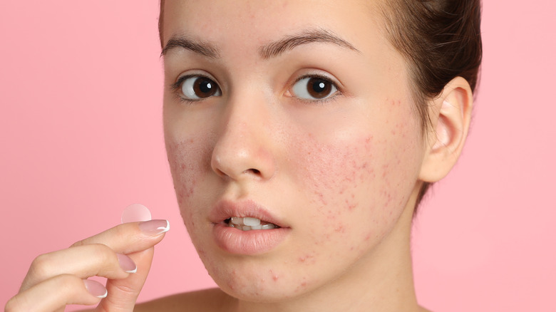 woman with rosacea