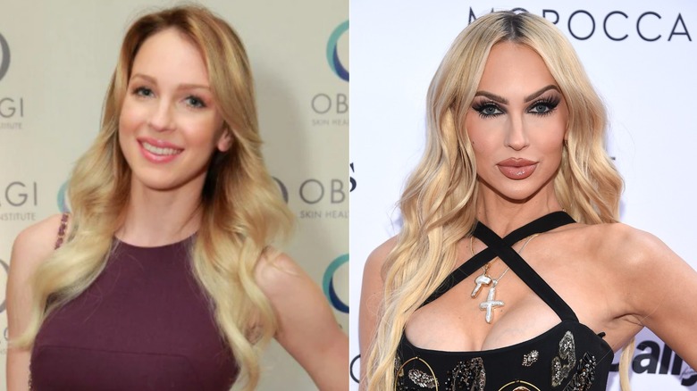 Side by side pictures of "Selling Sunset"'s Christine Quinn before cosmetic procedures and after