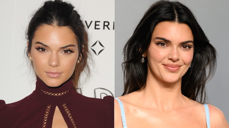 Side by side pictures of Kendall Jenner in 2015 and in 2026 at the Oscars party
