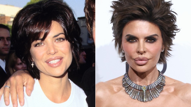 Lisa Rinna with husband Harry Hamlin in the 1990s and again in 2026