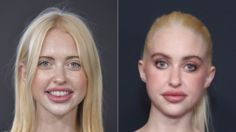 Chloe Cherry before and after