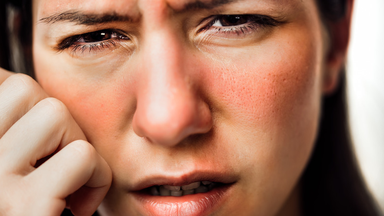 Woman with reddened cheeks