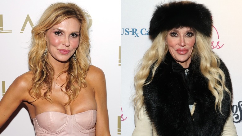 Split image of Brandi Glanville before and after
