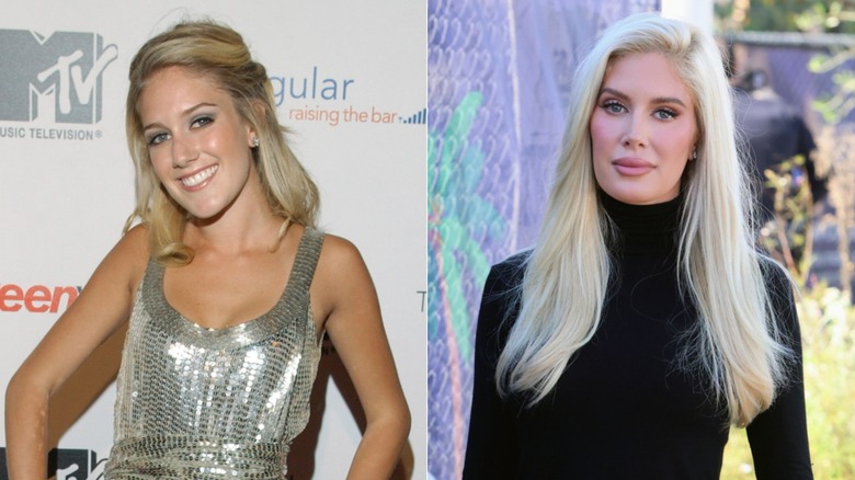 Split image of Heidi Montag before and after