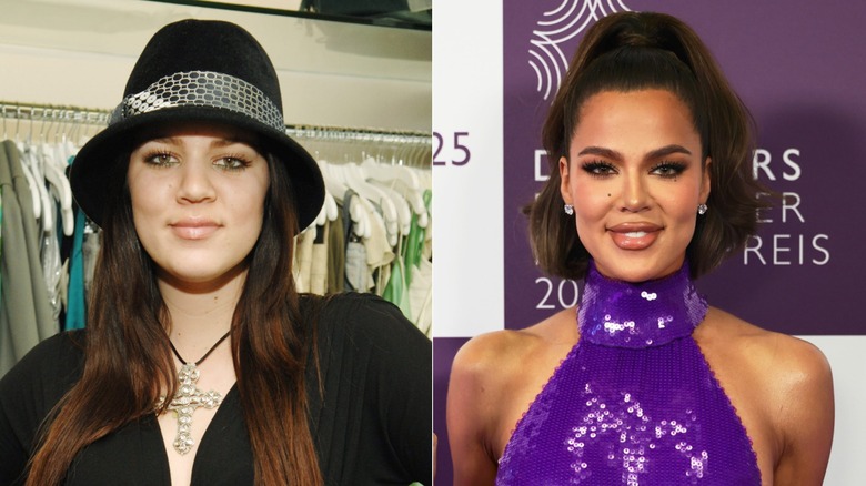 Split image of Khloé Kardashian before and after