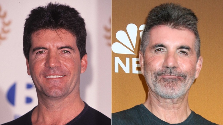 Split image of Simon Cowell before and after