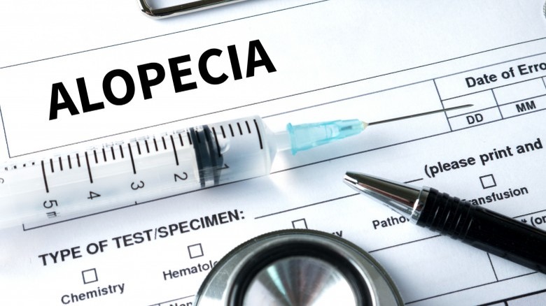 Alopecia