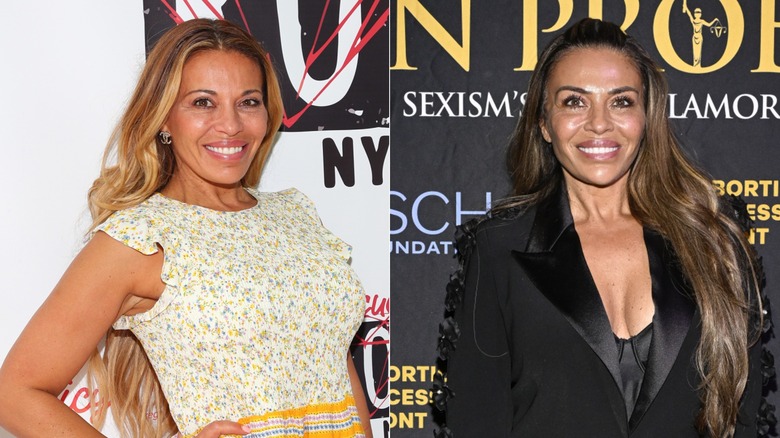 Split image of Dolores Catania before and after GLP-1