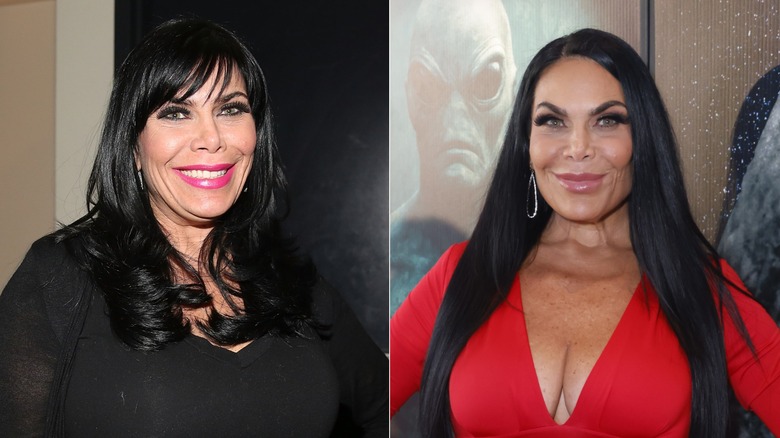 Split image of Renee Graziano before and after GLP-1
