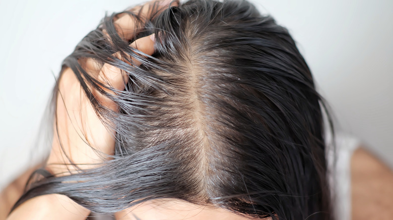 Woman with thinning hair