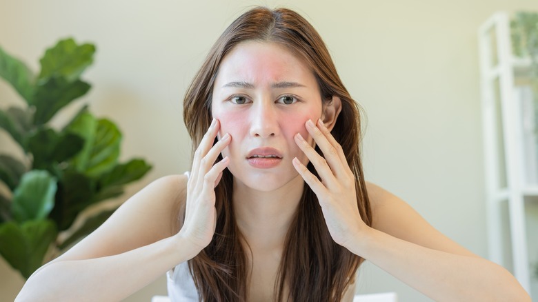 Woman with rosacea looking worried