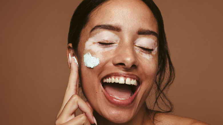 Woman with vitiligo applying product to her face