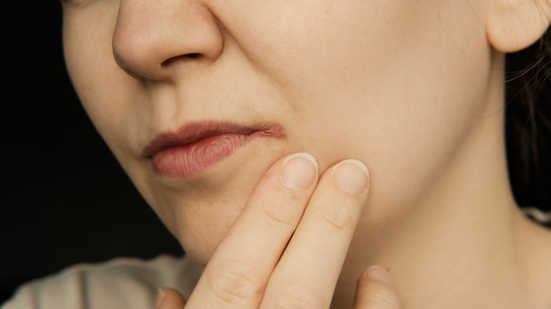 Woman with sore corner of mouth