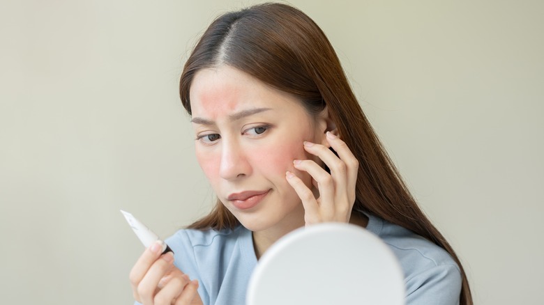 Woman with red blotchy skin