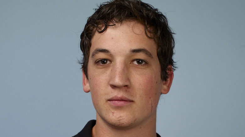 Miles Teller with facial scars
