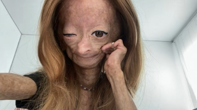 YouTuber Adalia Rose Williams