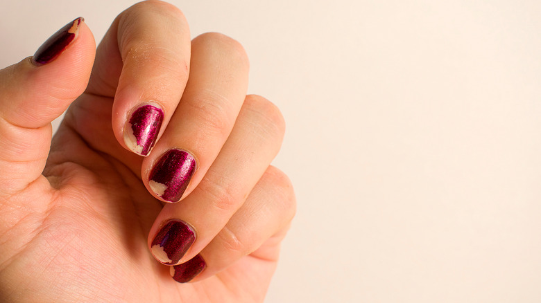 A chipped red manicure 