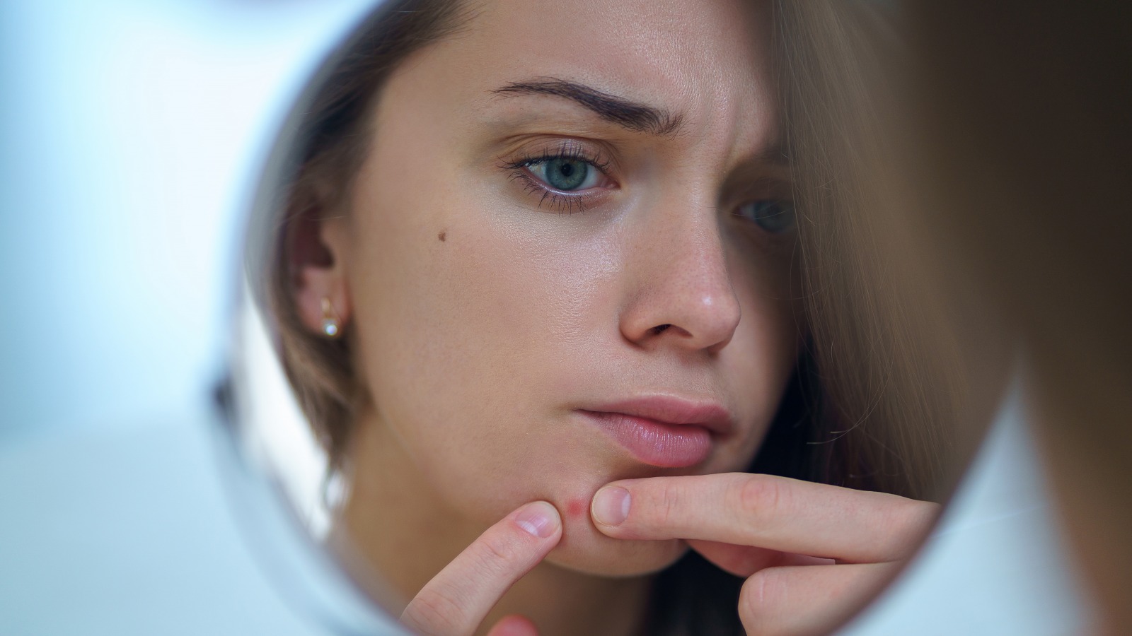 The Real Reason You Start Breaking Out After A Breakup