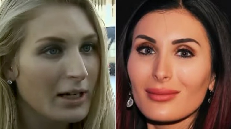 composite pic of Laura Loomer before and after Mar-a-Lago face transformation