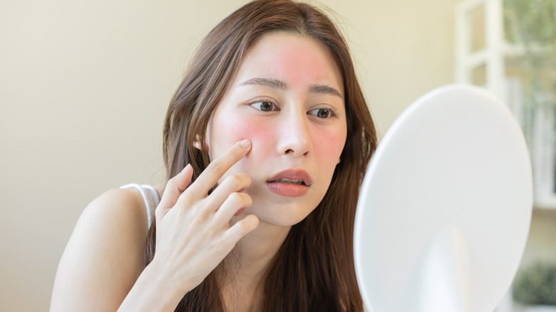 Woman touching sunburn on face