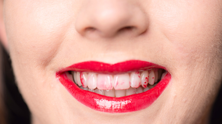 Woman with lipstick on teeth