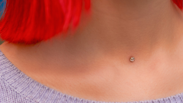 In dermals put how are Dermal Anchors
