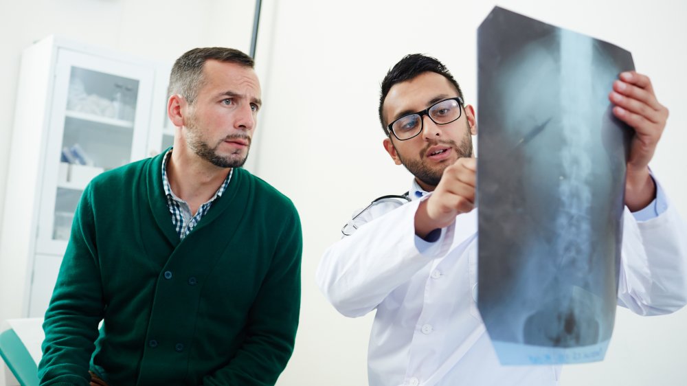 spinal cord images