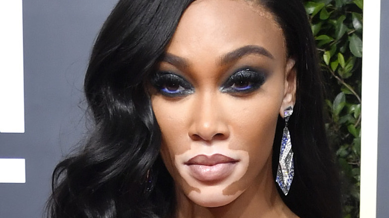 Model Winnie Harlow poses on the red carpet