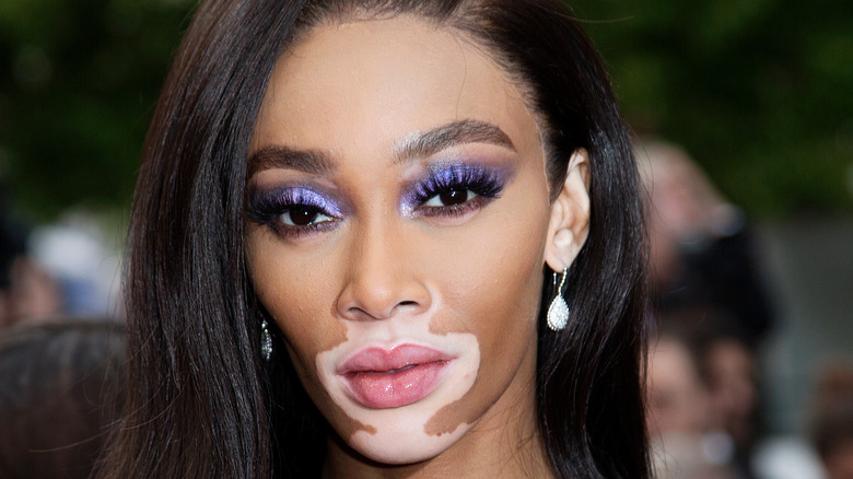 Winnie Harlow posing