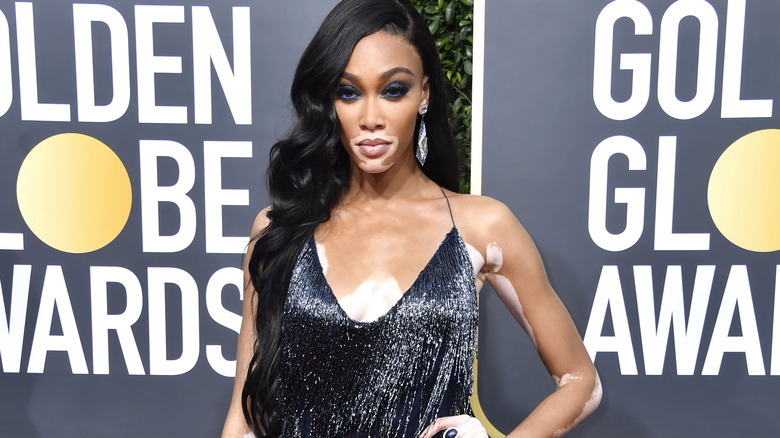 Winnie Harlow