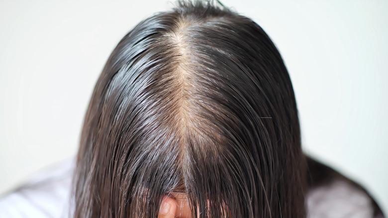 ladies hair thinning