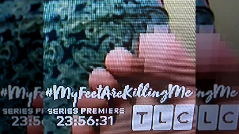 TLC promo foot for TLC's My Feet Are Killing Me