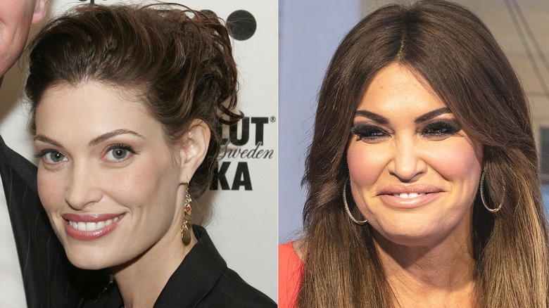 Kimberly Guilfoyle before/after rumored surgery