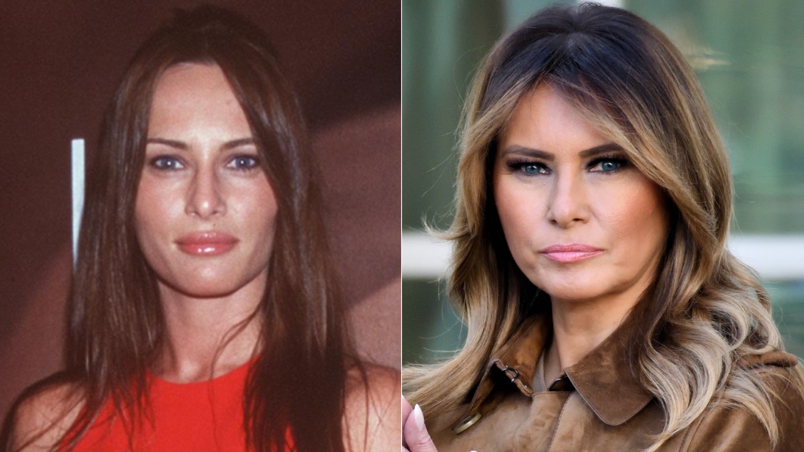 Melania Trump Rumors Of Plastic Surgery What Are The Facts - ys9tb2l