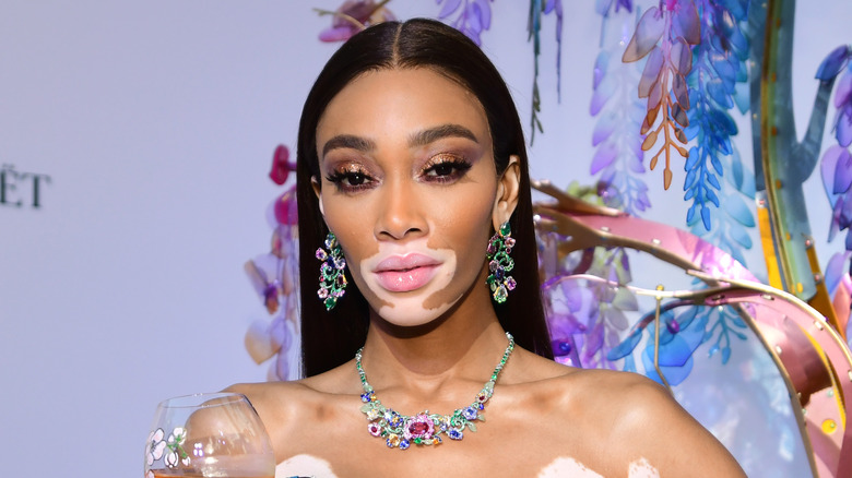 Winnie Harlow close-up