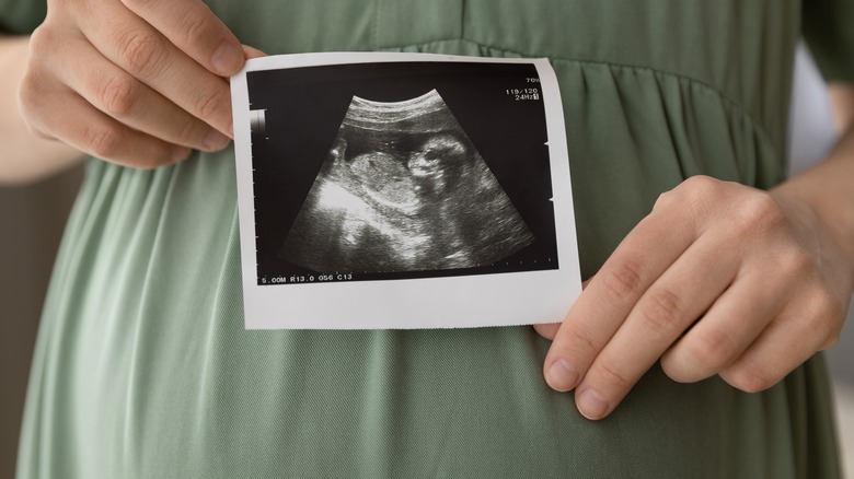pregant woman holding ultrasound