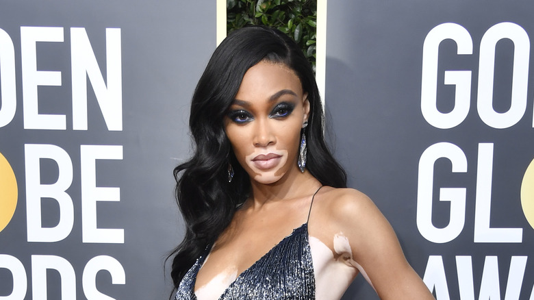 Winnie Harlow