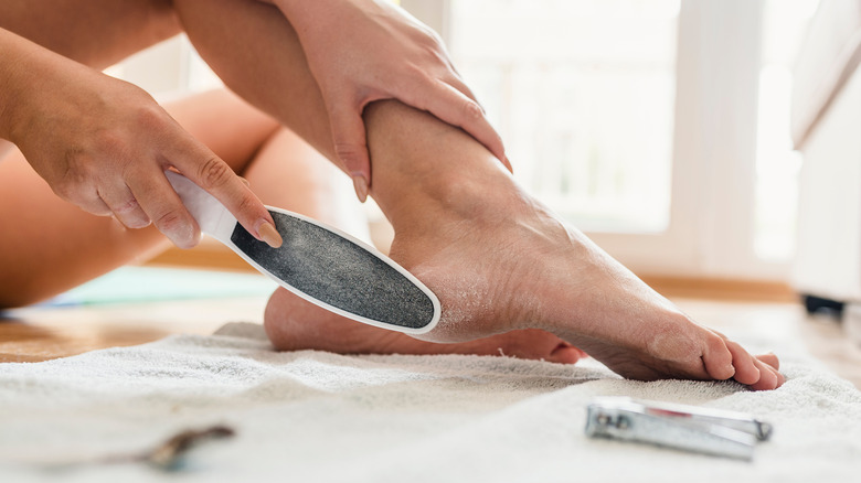 Woman removing her calluses