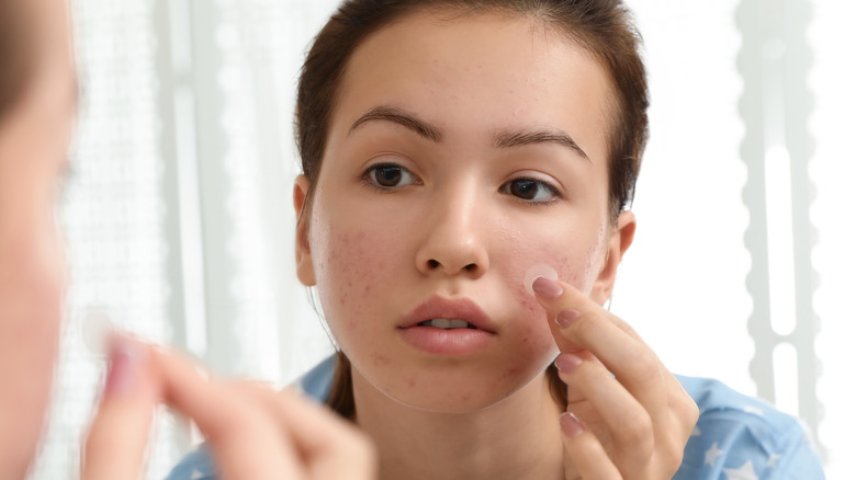 Woman applying a hydrocolloid patch close up