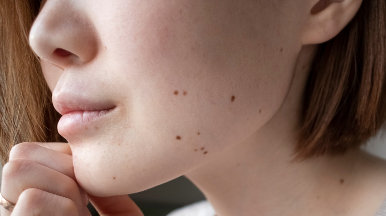 Your Face Moles Reveal About Your Personality 