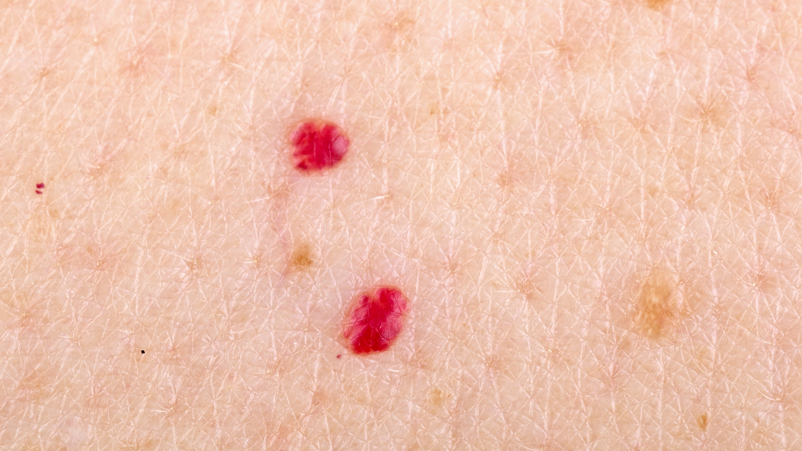 This Is Why You Have Red On Your Skin When You Should Get Worried)