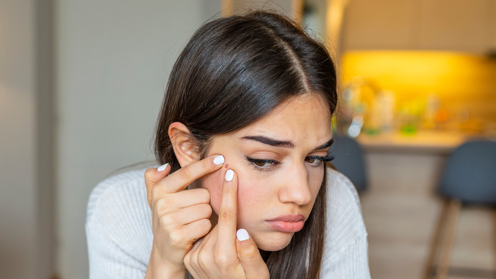 A woman examining a pimple 