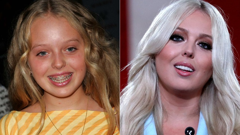Composite of before and after blonde photos of Tiffany Trump