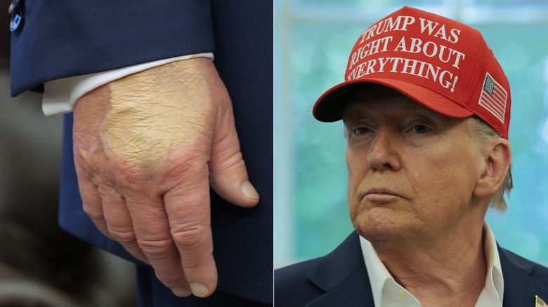 split screen of Donald Trump's obvious hand makeup and Donald Trump looking into the distance