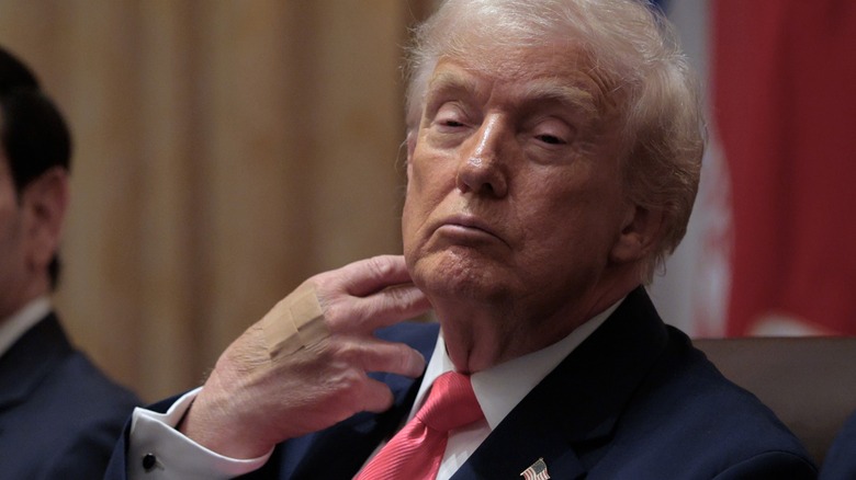 President Donald Trump wears adhesive bandages on the back of his hand during a meeting of his cabinet in the Cabinet Room of the White House