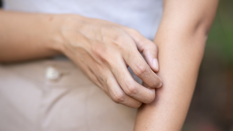 woman scratching her arm