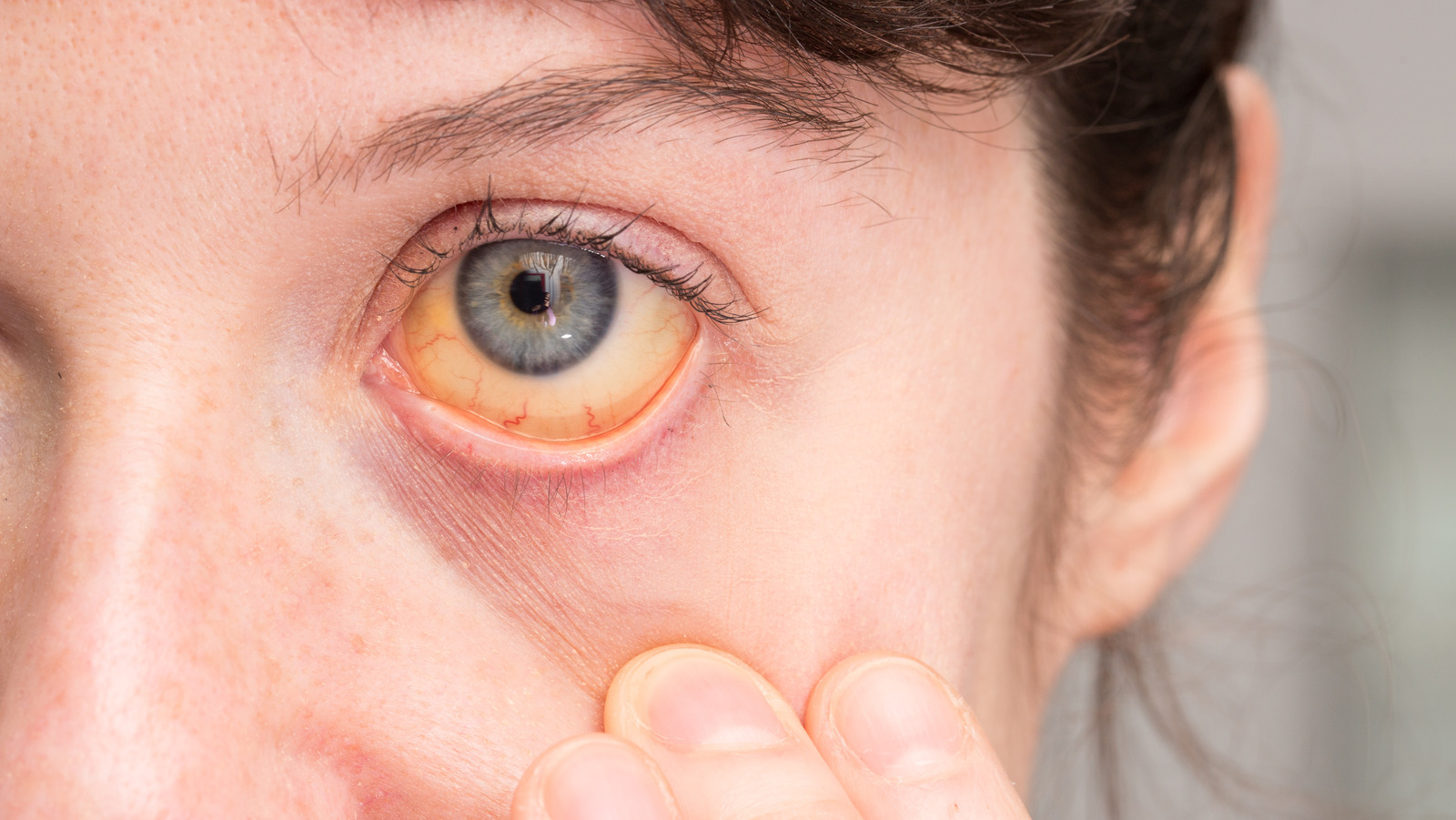 eye health problems | Flourish