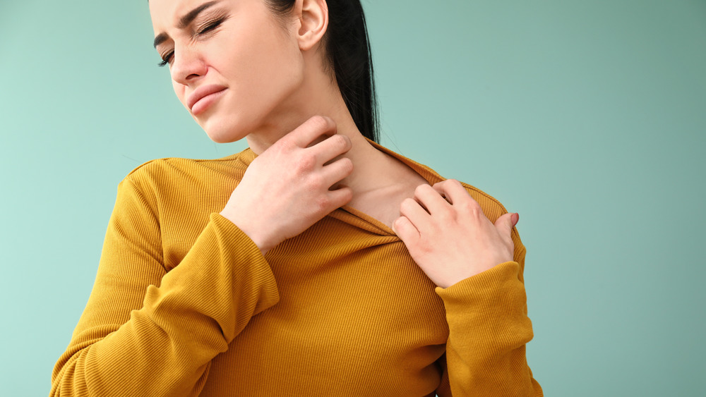 A woman itching her hives