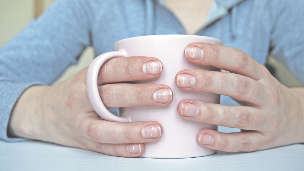 What Does It Mean When You Get White Spots On Your Fingernails?