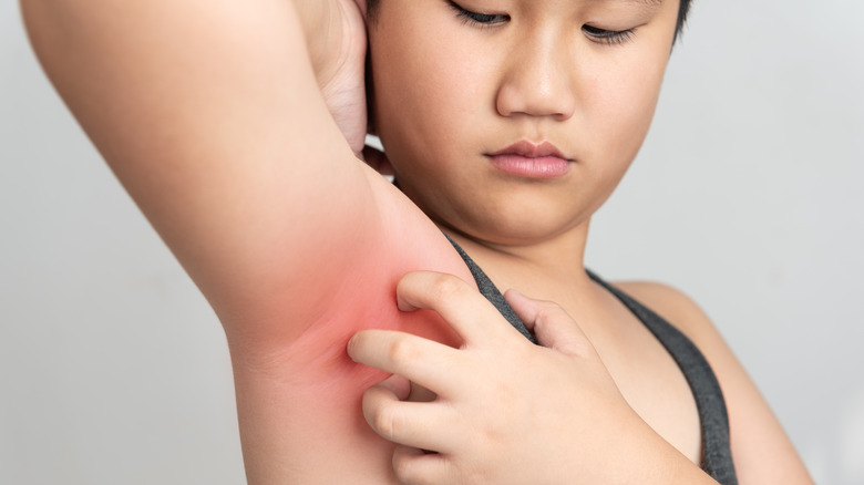 Woman scratching red skin under her arm